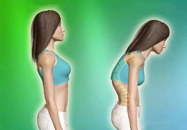 4个简单动作改善驼背含胸以及颈前倾帮助塑造完美体态