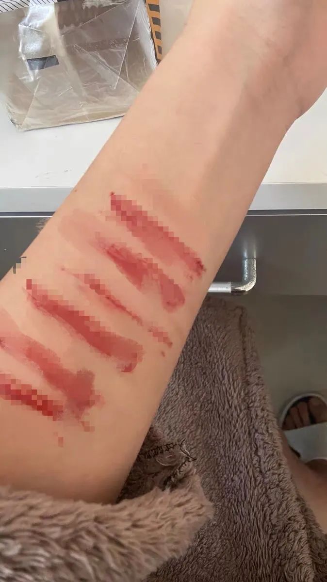 割腕取血制作项链当信物,年轻人们玩起这个……医生:自采血有感染风险