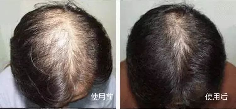 女生掉多少头发算脱发？看完有点慌休闲区蓝鸢梦想 - Www.slyday.coM