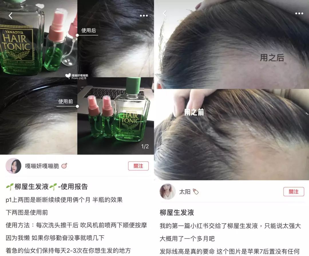 女生掉多少头发算脱发？看完有点慌休闲区蓝鸢梦想 - Www.slyday.coM