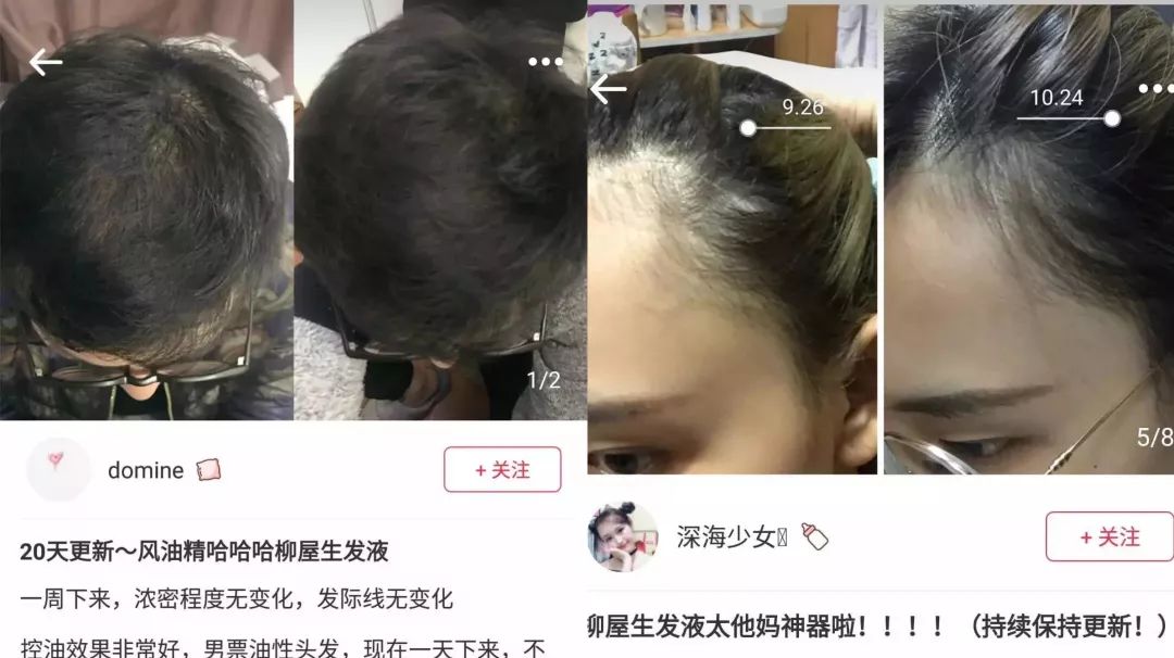 女生掉多少头发算脱发？看完有点慌休闲区蓝鸢梦想 - Www.slyday.coM