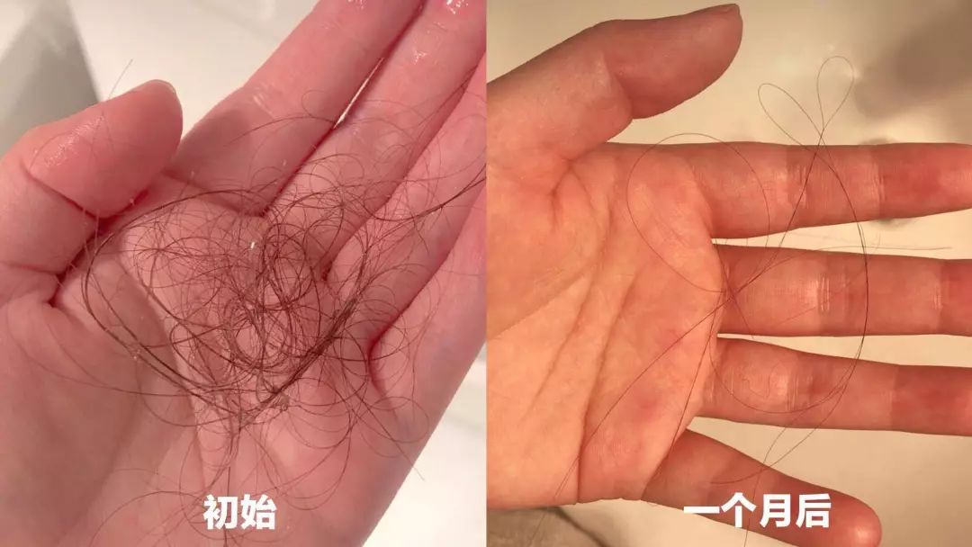 女生掉多少头发算脱发？看完有点慌休闲区蓝鸢梦想 - Www.slyday.coM