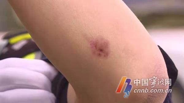 奉化一女子骑车不戴头盔被查 最后竟咬民警一口发泄不满休闲区蓝鸢梦想 - Www.slyday.coM
