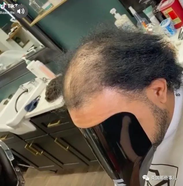 理发师专让秃顶的男人找回自信这效果简直犹如换头啊