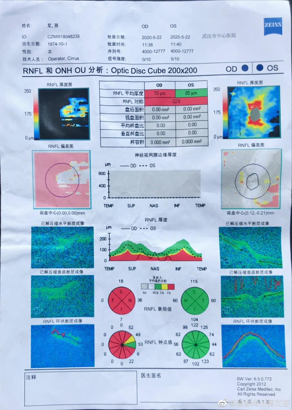 爱尔眼科称视网膜脱离与手术无关艾芬回应避重就轻混淆视听