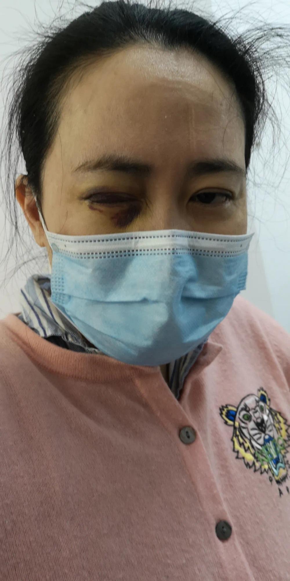 爱尔眼科称视网膜脱离与手术无关艾芬回应避重就轻混淆视听