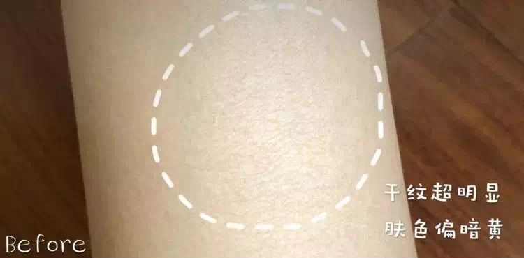 抹身体乳一片红是过敏吗(抹身体乳一片红是过敏吗怎么办) 抹身体乳一片红是过敏吗(抹身体乳一片红是过敏吗怎么办)