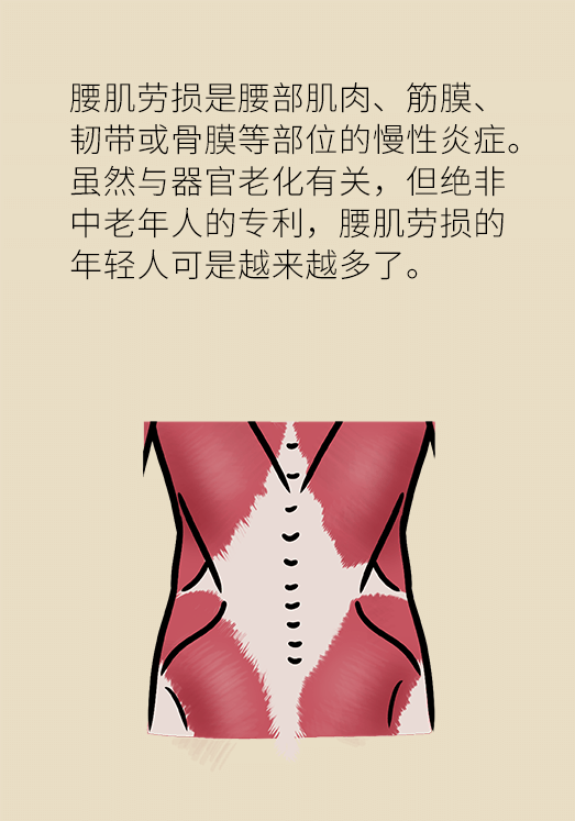 久坐久站致腰肌劳损?六招教你战胜腰痛