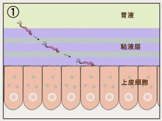感染率高达55%!孩子得了这个病,罪魁祸首竟然是家长