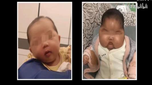 一款婴儿抑菌霜致“大头娃娃”？背后公司疑点重重