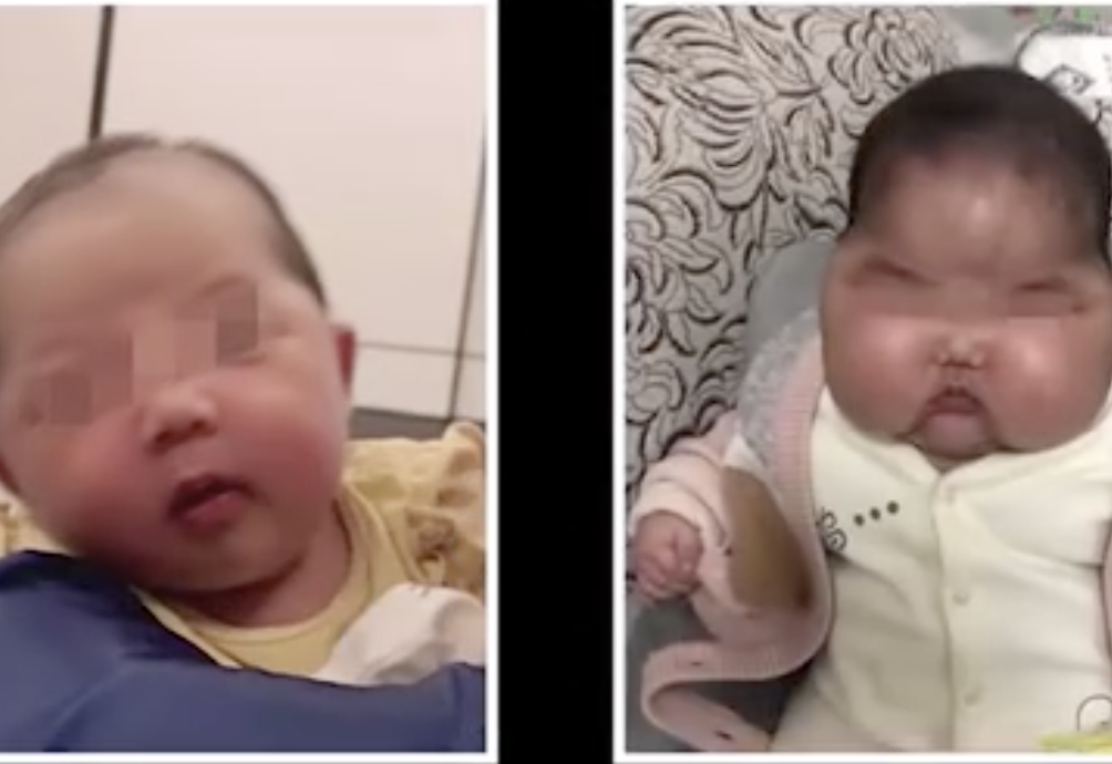 婴儿用抑菌霜后成“大头娃娃”？官方回应