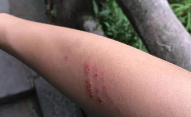 对于猴子伤人事件,全国很多名山也都有过同样的困扰.