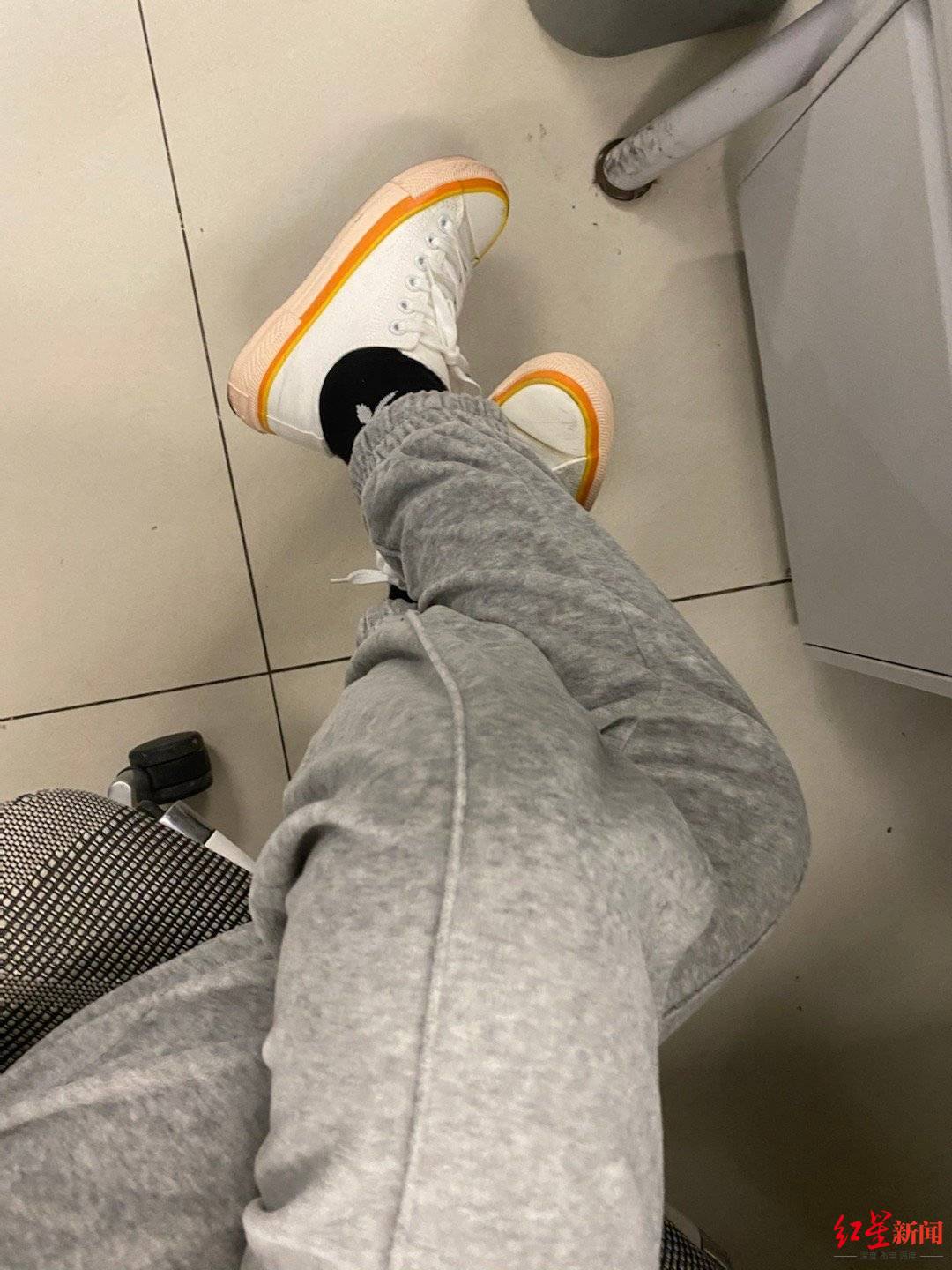 32岁it男跷二郎腿致脊柱扭成麻花医生还影响颜值