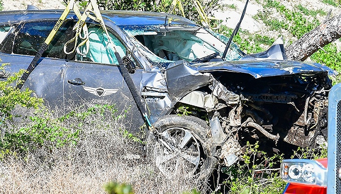 老虎伍兹遭遇严重车祸双腿多处骨折