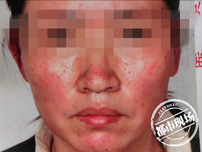 江西女子脸通红成这样为何