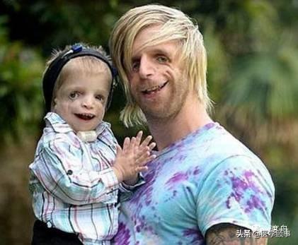 什么是不宁腿综合征?