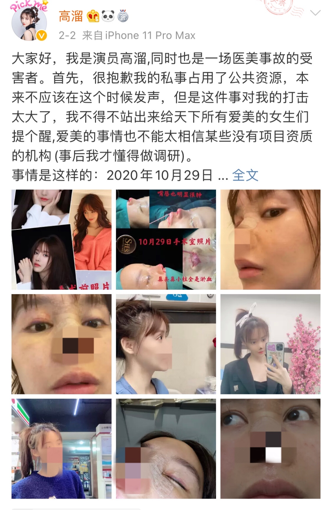 女演员自曝整容失败 当地卫健局介入广州熙施时光有前科 天下财经报道