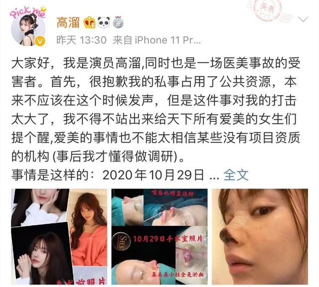 女演员自曝整容失败 丢了工作还要赔0万 当地卫健局已介入 财经头条 女演员自曝整容失败 丢了工作还要赔0万 当地卫健局已介入 财经头条