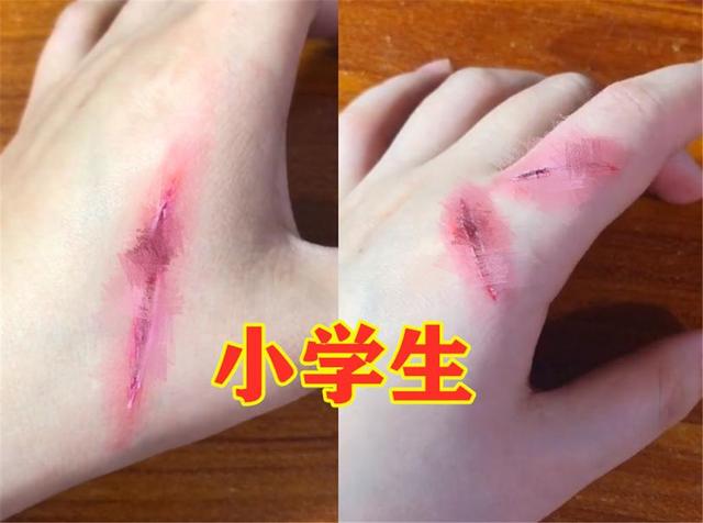 小学生开始流行画伤疤反映孩子心理状态父母能看出吗