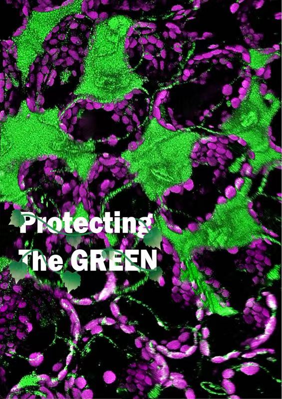 植物免疫系统协同放大活性氧产生来抵抗病原菌的入侵&nbsp; 本文图片均为受访者供图