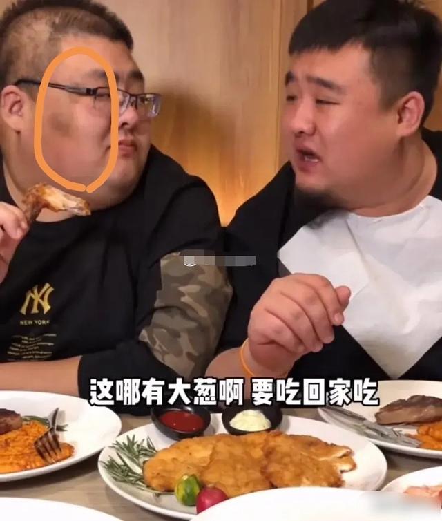 ps:小编友情提醒,这位吃播泡泡龙先生脸上这种皮肤