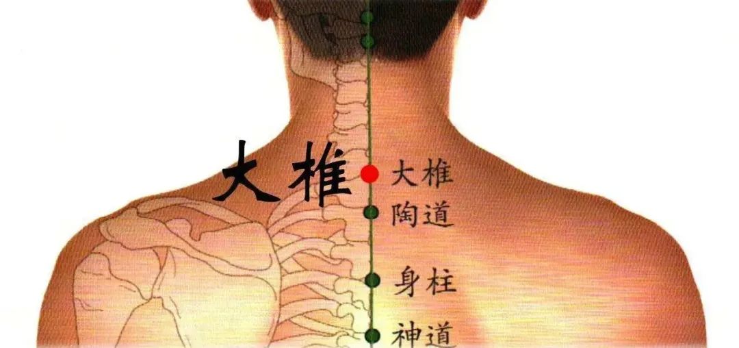 背部艾灸推荐4个穴位:大椎穴,风门穴,身柱穴和命门穴.