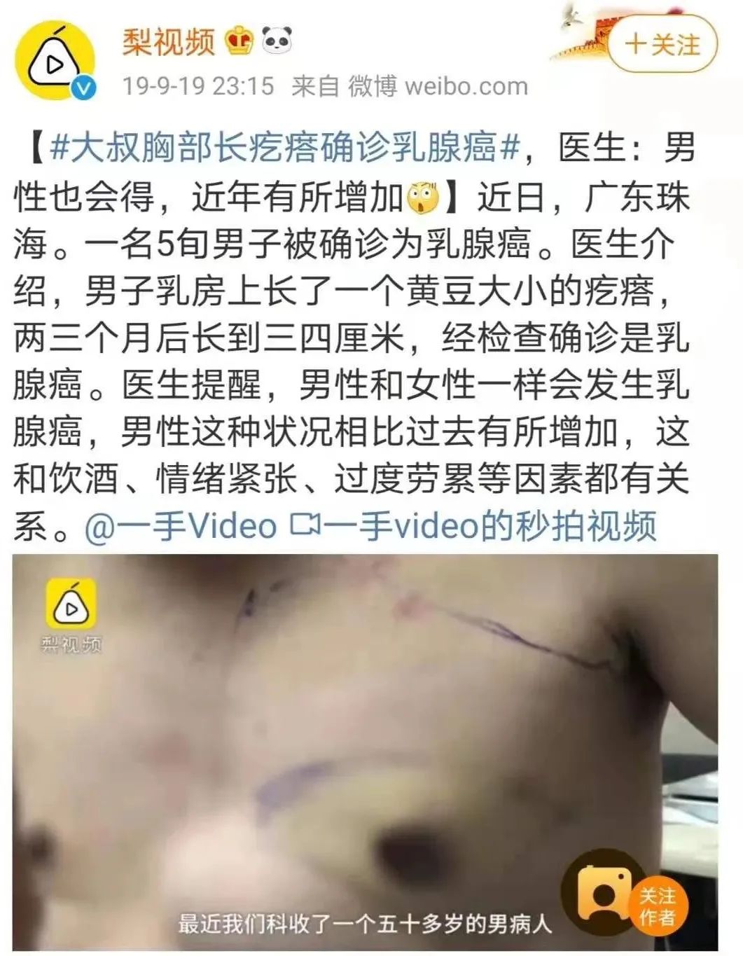 男子胸部长小疙瘩，一查竟是乳腺癌！身体5处长疙瘩是癌的信号，别以为只是小毛病休闲区蓝鸢梦想 - Www.slyday.coM