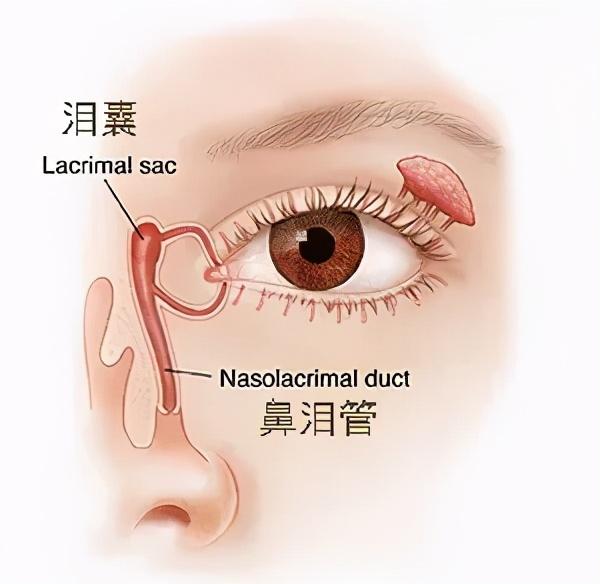 02什么是鼻泪管阻塞?还有的孩子早晨起来,眼屎很多,甚至会把眼睛糊上.