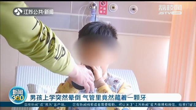 江阴10岁男孩上学突然晕倒 竟然从气管里取出一颗牙休闲区蓝鸢梦想 - Www.slyday.coM