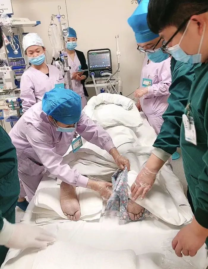 济南三院重症医学科开展首例俯卧位通气