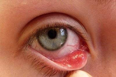 "平时大家可以多关注一下眼睛的健康问题,譬如出现视力下降,看东西