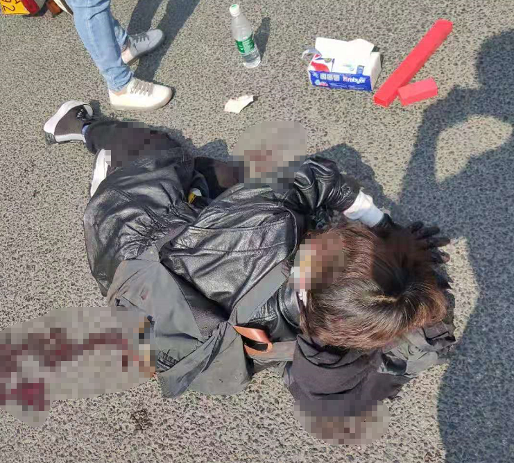 贵阳街头发生车祸，女子被撞头破血流！两男子马上停车……休闲区蓝鸢梦想 - Www.slyday.coM