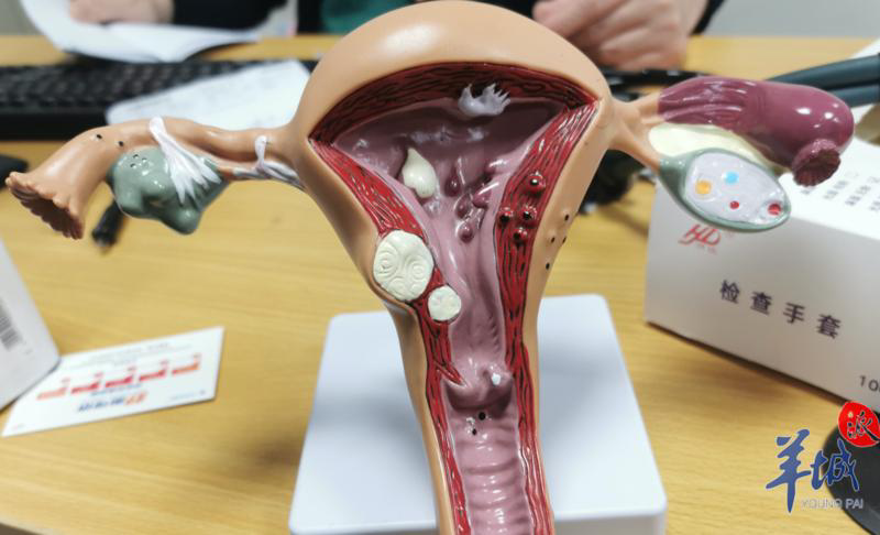 生完孩子痛经就能改善?别再傻傻地相信了