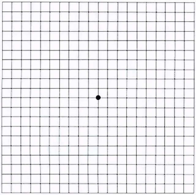 正常黄斑的眼底oct图像需要注意的是,黄斑变性治疗不及时可导致眼睛
