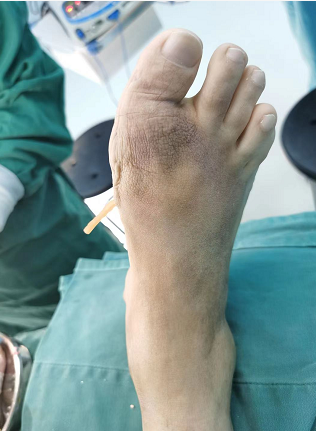 宁夏|宋强|痛风_新浪新闻