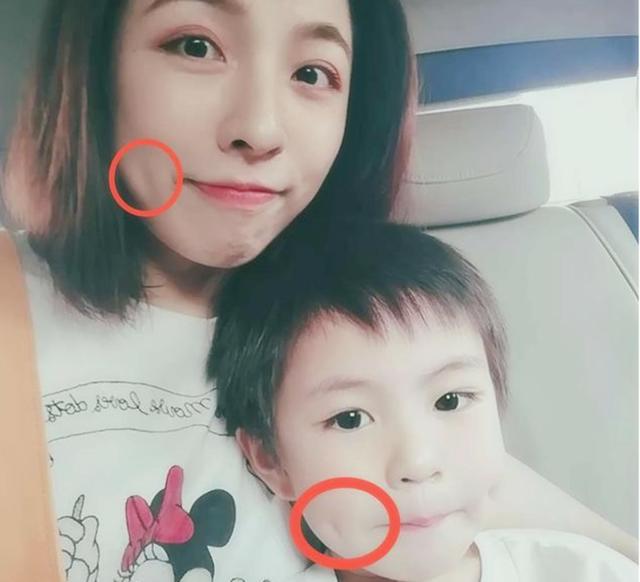 酒窝宝宝是妈妈的“前世恋人”?这几种类型的酒窝,你家娃占哪个