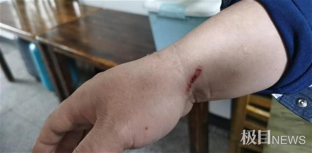 武汉一餐馆老板灭火右手被烫伤，火熄灭后自己默默离开休闲区蓝鸢梦想 - Www.slyday.coM