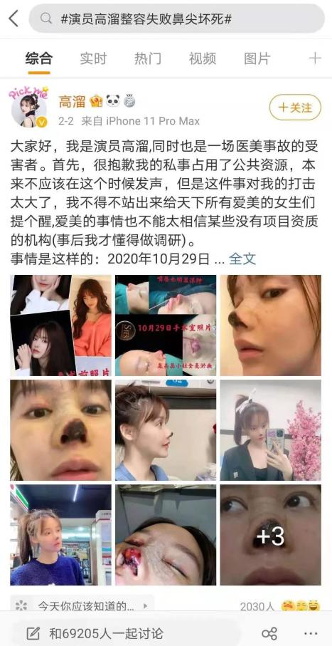 女演员整形失败致鼻尖坏死，官方通报：停业6个月罚款4万9