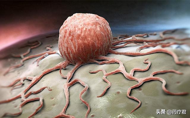 以为是痔疮却查出了肿瘤医生它的发病率不到十万分之一