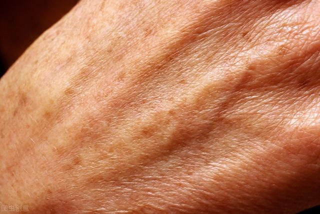 用此药膳能防治老年斑改善心脑血管系统