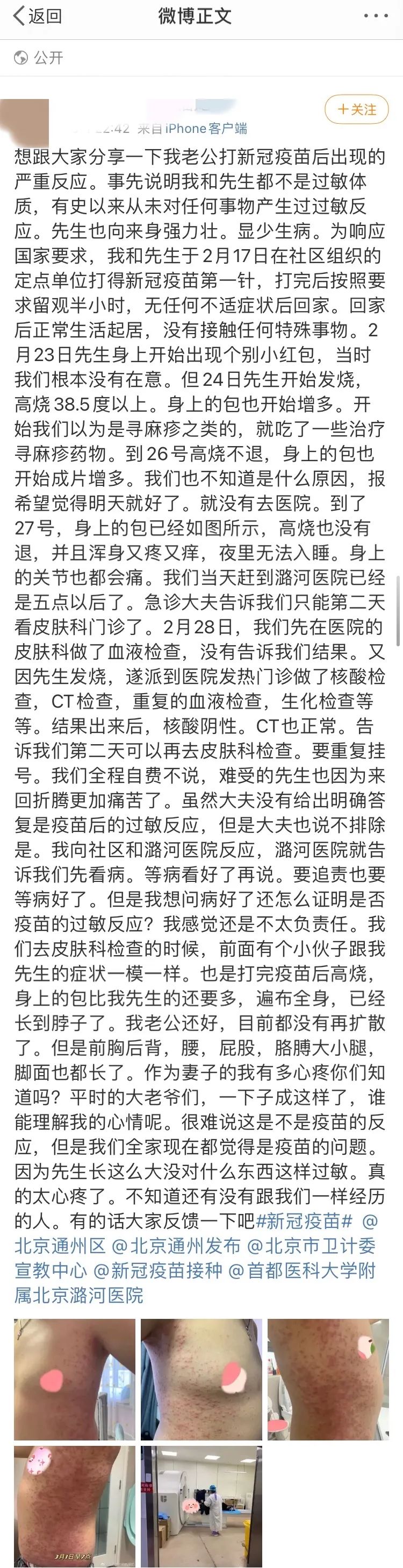 网友称接种新冠疫苗后全身「小红包」：怎样算不良反应？责任风险谁担？休闲区蓝鸢梦想 - Www.slyday.coM