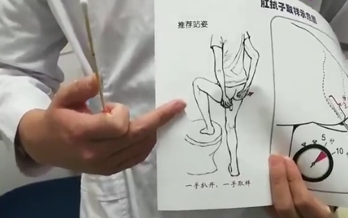 肛拭子检测为什么会引发外交抗议休闲区蓝鸢梦想 - Www.slyday.coM