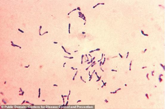 研究:对多种抗生素产生耐药性 白喉或再次成为全球重大威胁