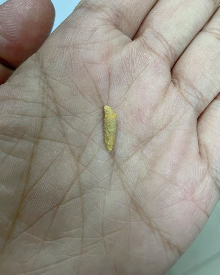 被捏断后还剩2/3的涎石.