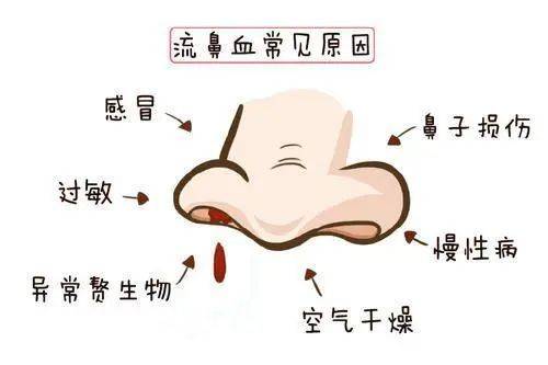 流鼻血|鼻粘膜|症状_新浪新闻