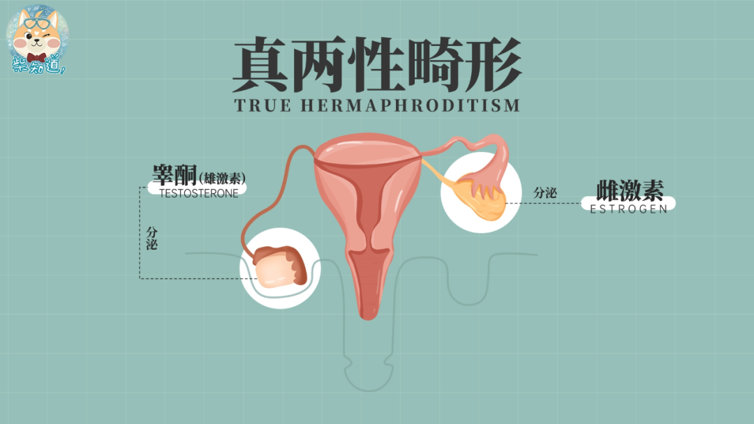 人类有多少种生理性别你的性别是由什么决定的图文