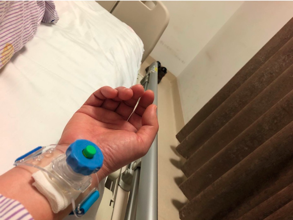 这是术后压在手腕上的"手铐"  |作者供图在住院的三天里,每天早晨5:00