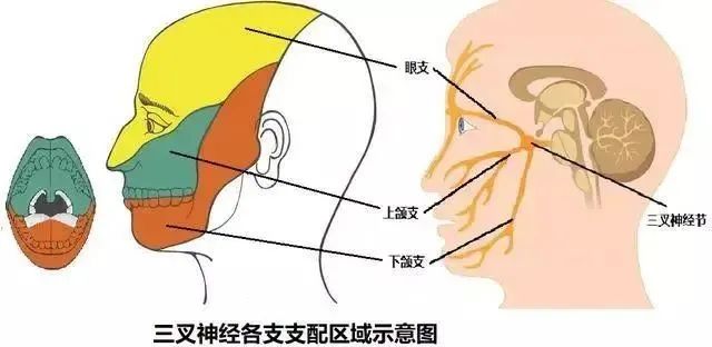 三叉神经是覆盖在我们面部的神经,分为眼神经,上颌神经和下颌神经三支