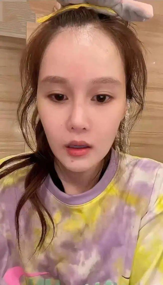 赵本山女儿坦言整容素颜皮肤状态很糟糕皮肤暗淡还有痘印