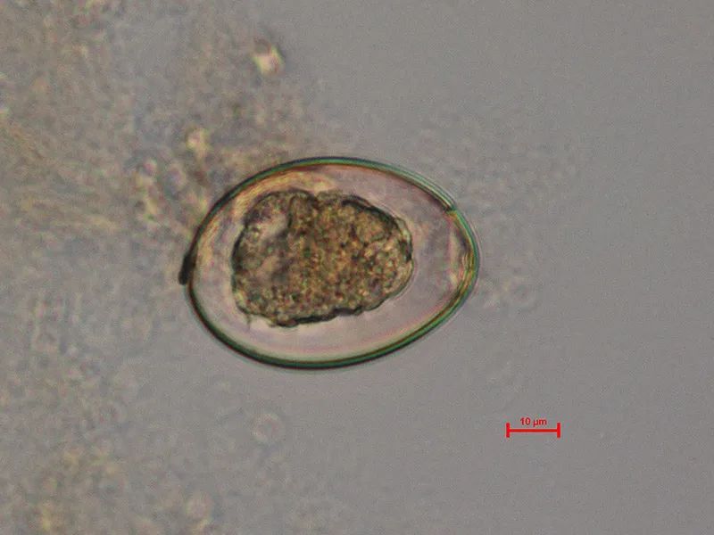 微小短壳膜绦虫卵图片